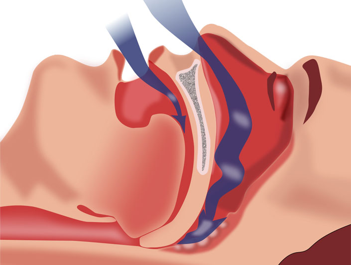 entrada del aire por vías respiratorias